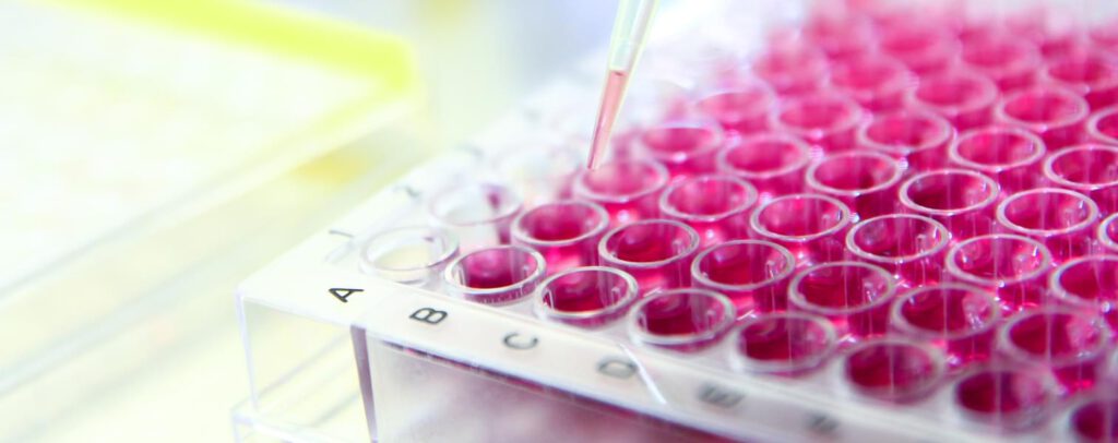 Image showing vaccine development